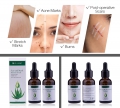 Scars and Marks Removal Serum Alternative Image 1