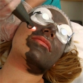 Skin Rejuvenation and Carbon Peel Laser Treatment Combo Alternative Image 1